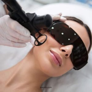 Alternatives To Laser Treatment For Acne Scars