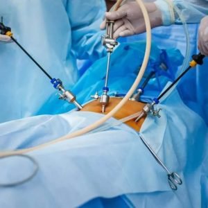 BM Hospitals_ Laparoscopic Myomectomy in Chennai