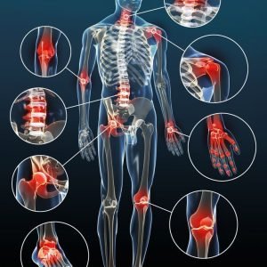 Warm-up aching joints__Ayurvedic medicine for joint pain